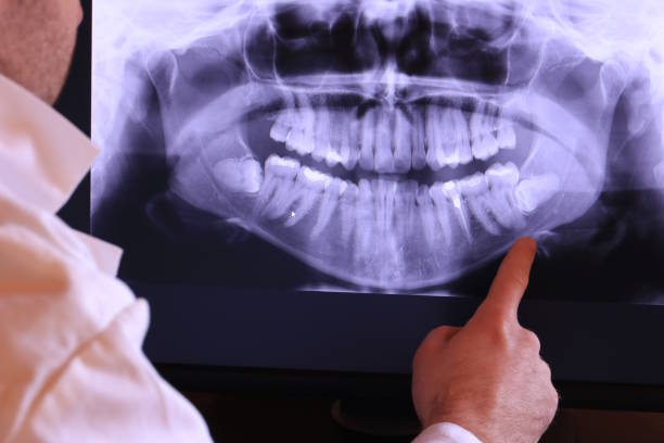 Best Holiday Emergency Dentist in Keene, NH
