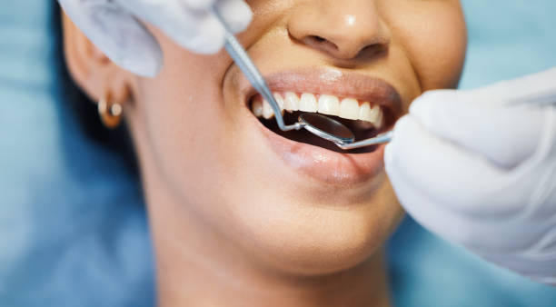 Best Emergency Dental Extractions in Keene, NH